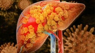 These 6 Warning Signs Show That Your Liver is Full of Toxins