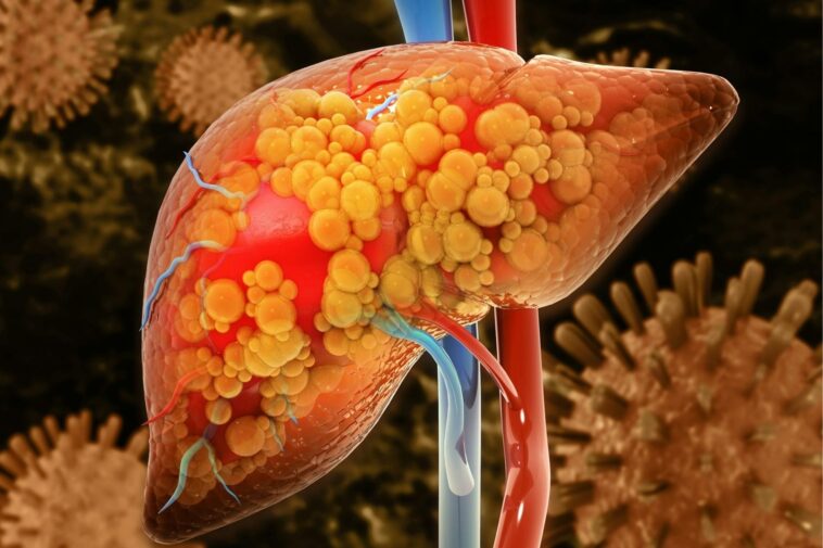 These 6 Warning Signs Show That Your Liver is Full of Toxins