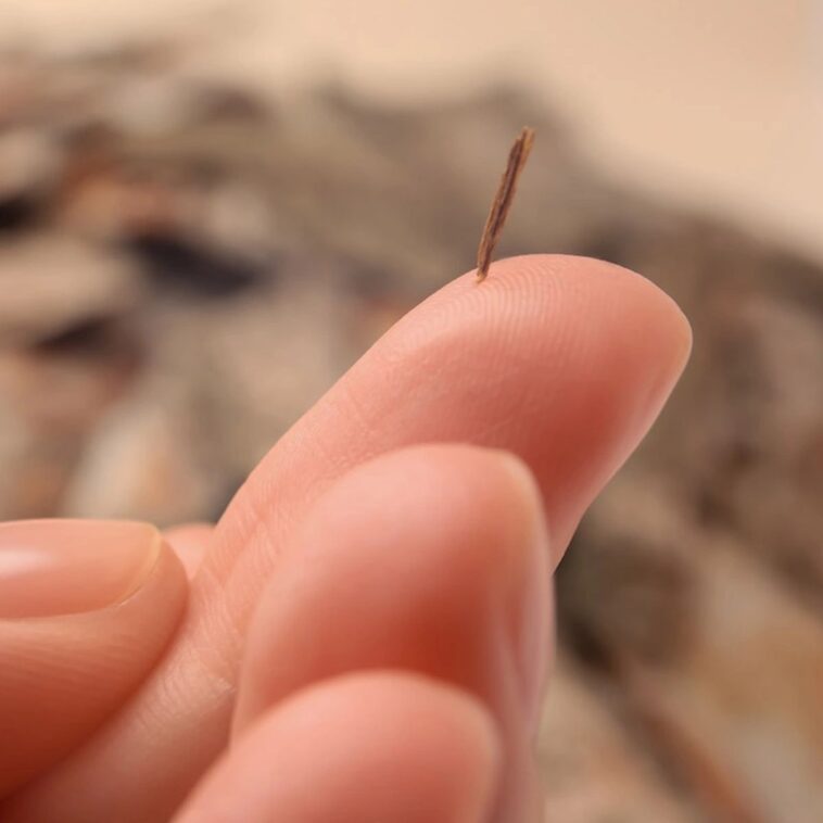 To Remove a Splinter, All You Need is This One Home Remedy