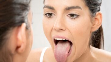 What Your Tongue Is Trying to Tell You About Your Health