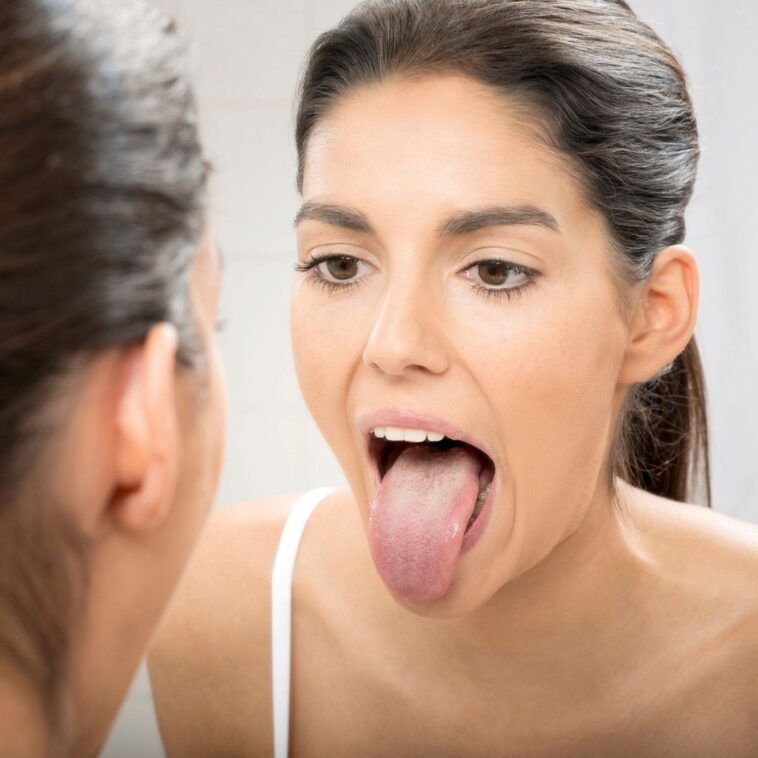 What Your Tongue Is Trying to Tell You About Your Health