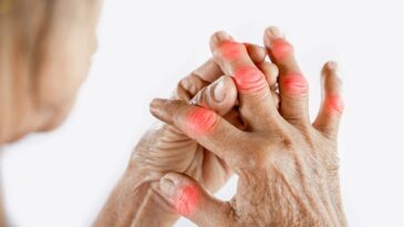 10 Ways to Relieve Thumb Joint Pain from Rhizarthrosis