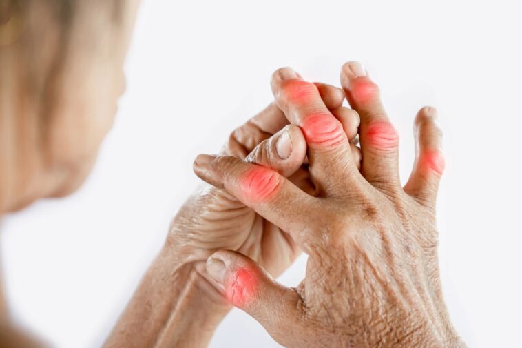 10 Ways to Relieve Thumb Joint Pain from Rhizarthrosis