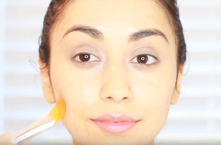 08 - lemon against acne and pimples