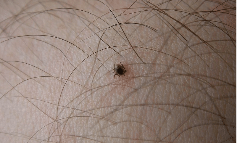 tick bite tick bite