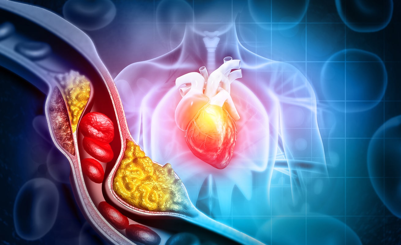 cholesterol