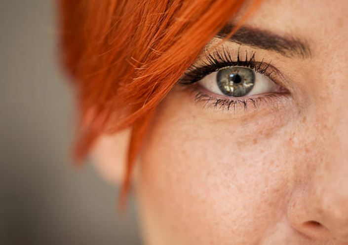 eye redhead freckles